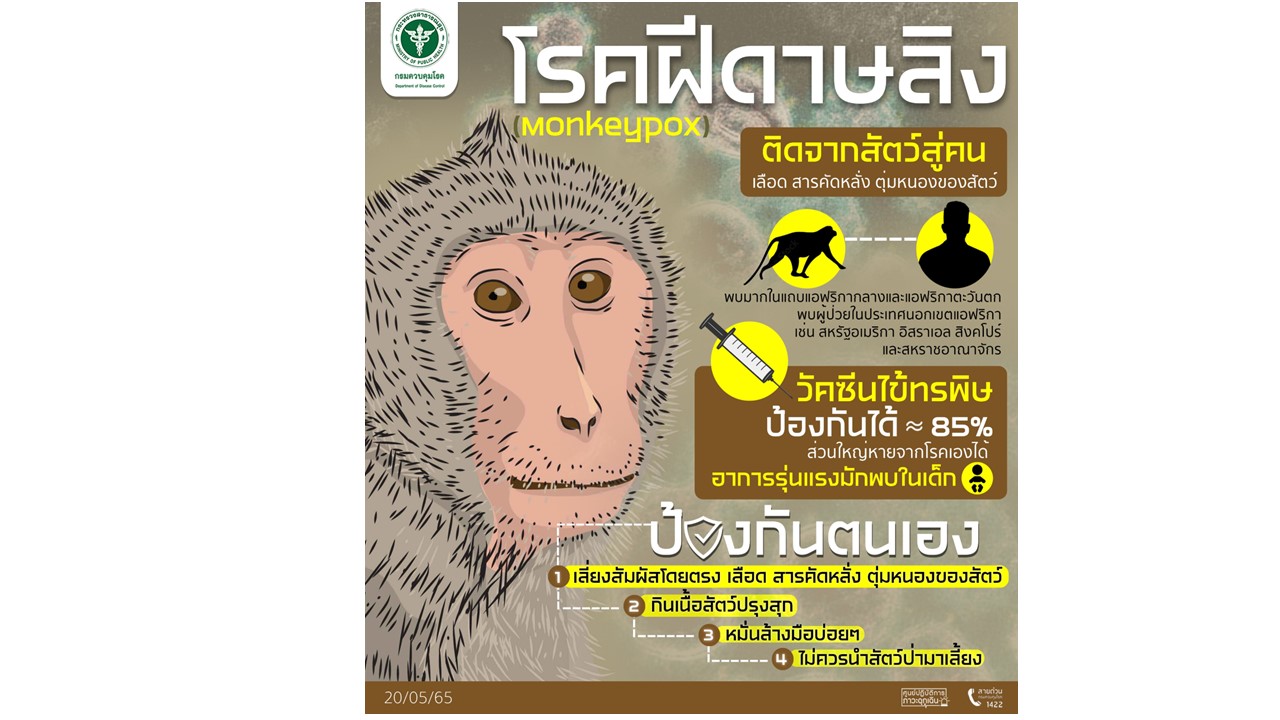 กรมควบคุมโรค เผยโรคฝีดาษลิงติดจากสัตว์สู่คนได้ แม้มีโอกาสติดน้อยแต่ต้องเฝ้าระวัง พร้อมแนะวิธีการป้องกัน